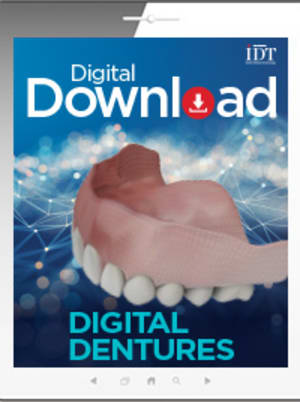 Digital Dentures