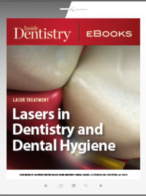 Lasers in Dentistry and Dental Hygiene