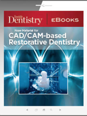 New Material for CAD/CAM-based Restorative Dentistry