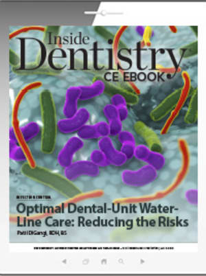 Optimal Dental-Unit Water-Line Care: Reducing the Risks