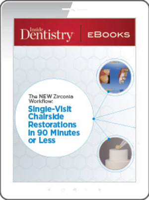 The New Zirconia Workflow: Single-Visit Chairside Restorations in 90 Minutes or Less
