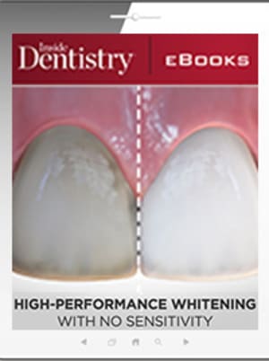 High-Performance Whitening With No Sensitivity