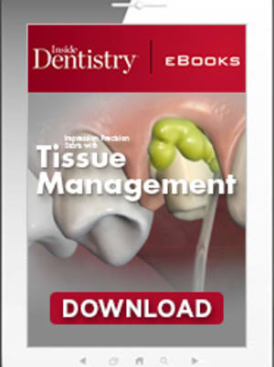 Impression Precision Starts with Tissue Management