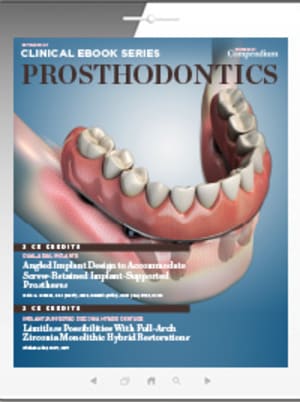 Prosthodontics 2