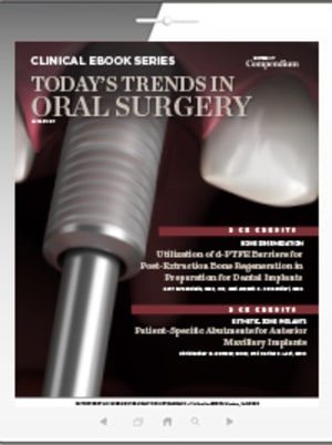 Today's Trends in Oral Surgery