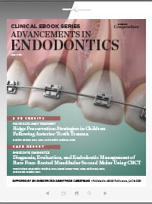 Advancements in Endodontics