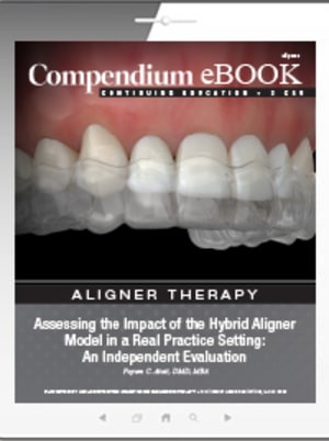 Assessing the Impact of the Hybrid Aligner Model in a Real Practice Setting: An Independent Evaluation