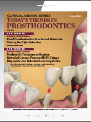 Today's Trends in Prosthodontics