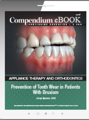 Prevention of Tooth Wear in Patients With Bruxism