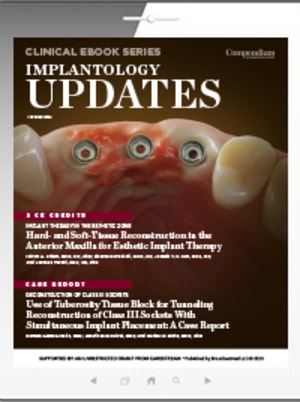 Implantology Updates