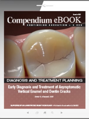 Early Diagnosis and Treatment of Asymptomatic Vertical Enamel and Dentin Cracks