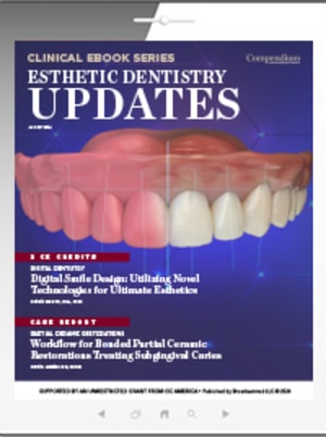 Esthetic Dentistry Updates