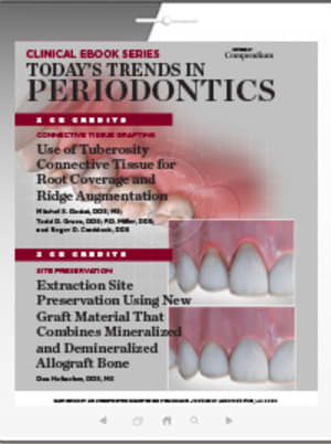 Today's Trends in Periodontics