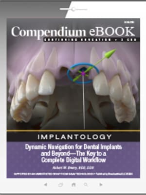 Dynamic Navigation for Dental Implants and Beyond—The Key to a Complete Digital Workflow