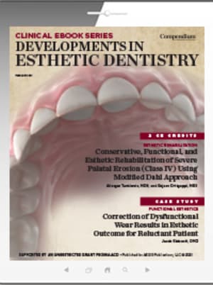 Developments in Esthetic Dentistry