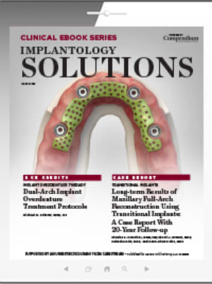 Implantology Solutions