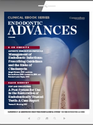 Endodontic Advances