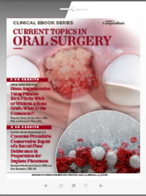 Current Topics in Oral Surgery