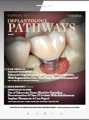 Implantology Pathways