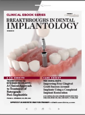 Breakthroughs in Dental Implantology | Compendium