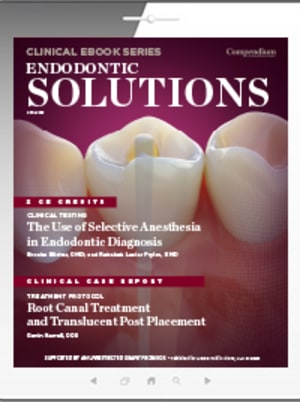 Endodontic Solutions