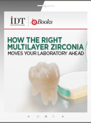 How the Right Multilayer Zirconia Moves Your Laboratory Ahead