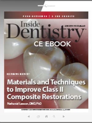 Materials and Techniques to Improve Class II Composite Restorations