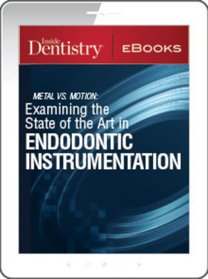 Metal Vs. Motion: Examining the State of the Art in Endodontic Instrumentation