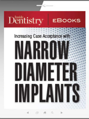 Increasing Case Acceptance with Narrow Diameter Implants