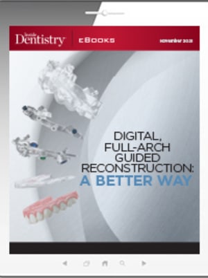 Digital, Full-Arch Guided Reconstruction: A Better Way