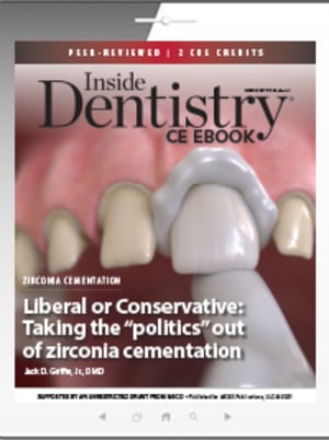 Liberal or Conservative: Taking the “politics” out of zirconia cementation