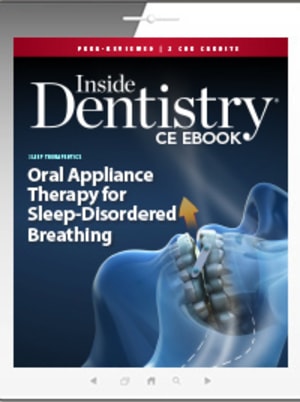 Oral Appliance Therapy for Sleep-Disordered Breathing