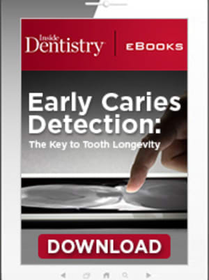 Early Caries Detection: The Key to Tooth Longevity