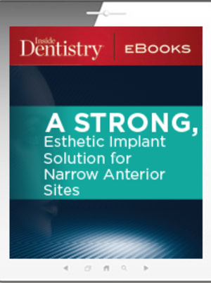 A Strong, Esthetic Implant Solution for Narrow Anterior Sites