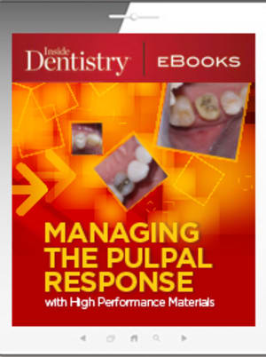Managing the Pulpal Response with High Performance Materials