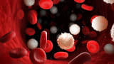Case-Based Insights in Relapsed AML: Monitoring and Managing Patients on Menin Inhibitors