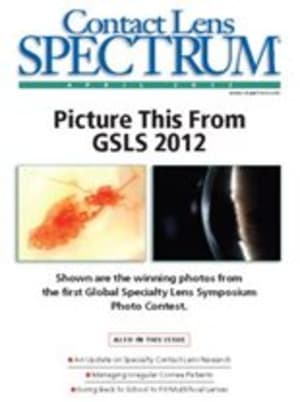 Contact Lens Spectrum