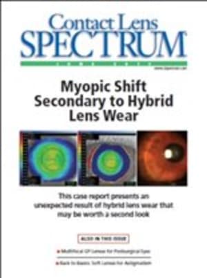 Contact Lens Spectrum