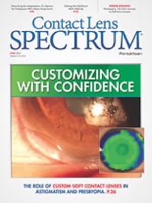 Contact Lens Spectrum