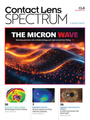 Contact Lens Spectrum