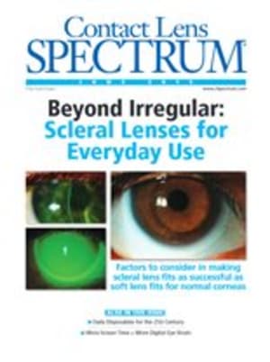 Contact Lens Spectrum