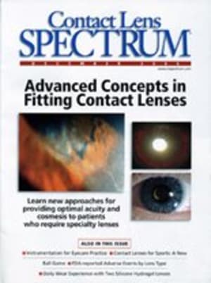 Contact Lens Spectrum