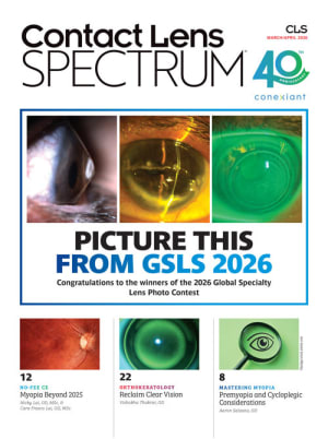 Contact Lens Spectrum