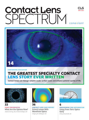 Contact Lens Spectrum