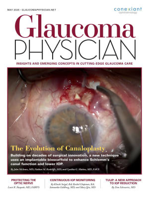 Glaucoma Physician