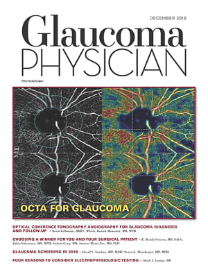 Glaucoma Physician