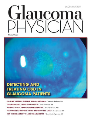 Glaucoma Physician