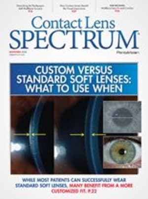 Contact Lens Spectrum