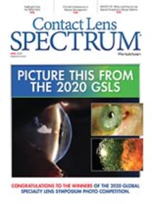 Contact Lens Spectrum