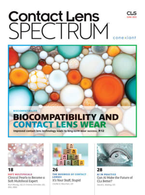 Contact Lens Spectrum